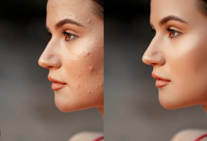 آموزش روتوش در فتوشاپ